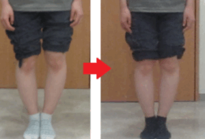 O脚　８月